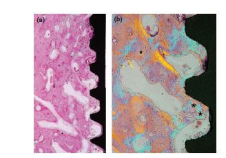 Osseointegration of dental implants installed without mechanical engagement