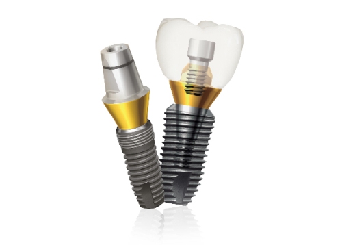A 5-year retrospective clinical study of the Dentium implants